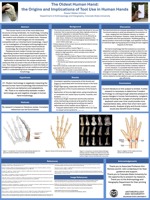 The Oldest Human Hand: The Origins and Implications of Tool Use in Human Hands